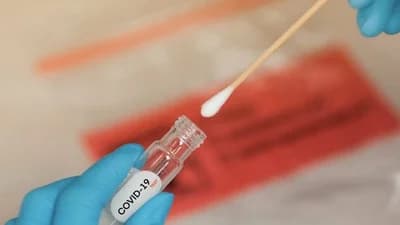 AUMENTAN LOS CASOS DE COVID-19 EN SANTA CRUZ, HAY 290 CONTAGIOS