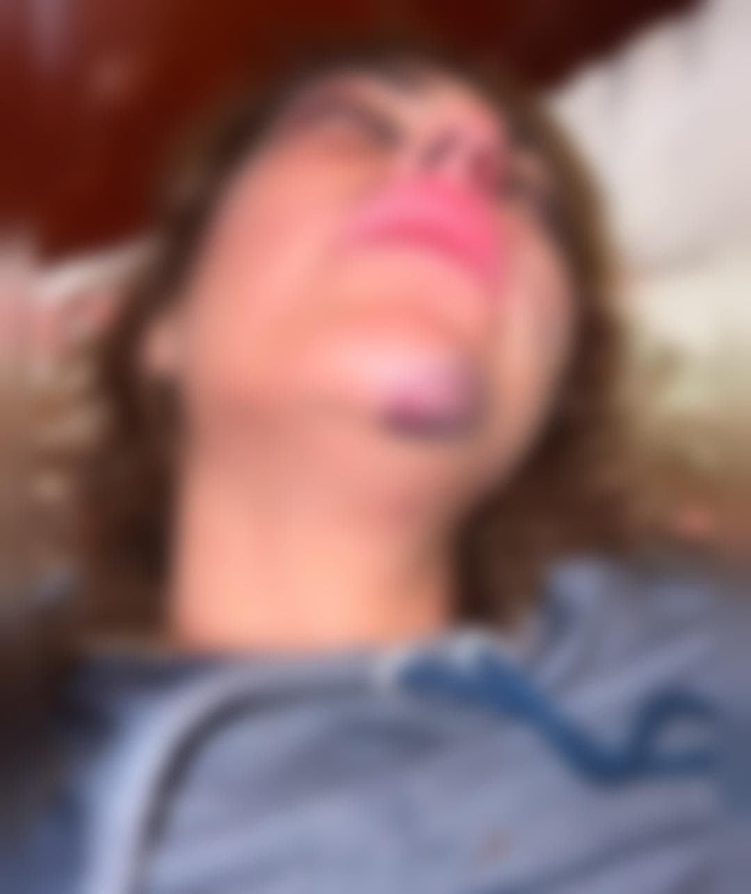 MUJER DENUNCIA BRUTAL AGRESIÓN PROPINADA POR SU EXPAREJA
