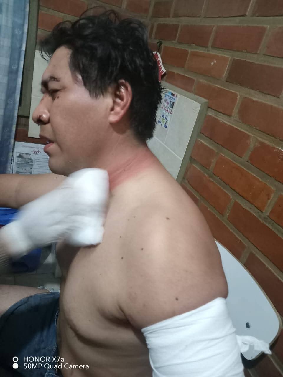 COLEGIO MÉDICO EXIGE REPLIEGUE POR ATAQUES A PERSONAL SANITARIO