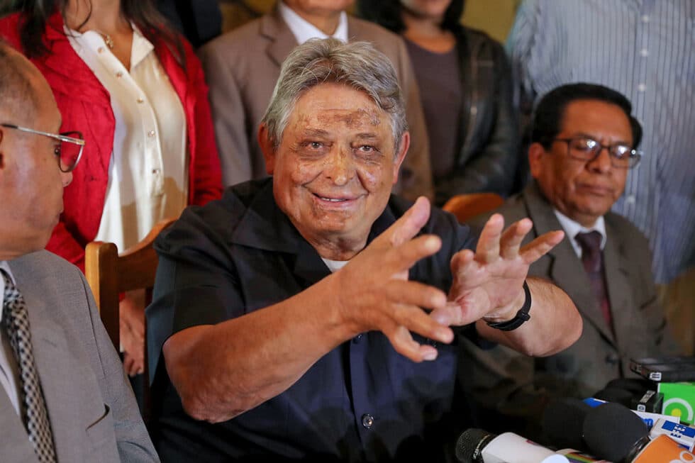 JAIME PAZ ZAMORA ENFRENTA UNA COMPLICACIÓN DE SALUD QUE AFECTÓ SU MOVILIDAD
