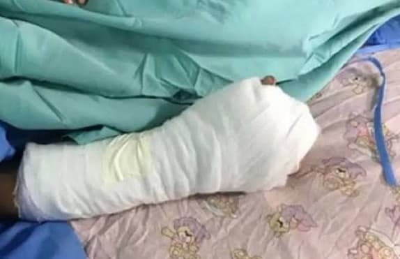 NIÑO SOBREVIVIENTE DEL INCENDIO PERMANECE EN TERAPIA INTENSIVA CON LESIONES CEREBRALES