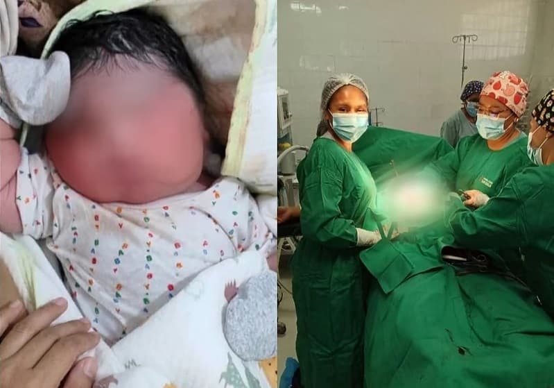 NACE UNA BEBÉ DE 6,85 KILOS TRAS UNA CESÁREA DE EMERGENCIA EN SAN BORJA