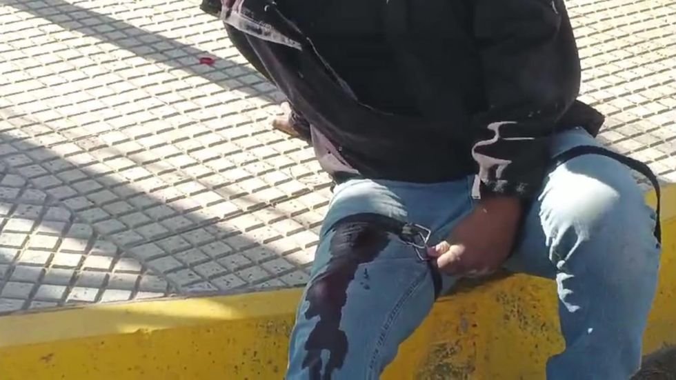 APUÑALAN A MOTOCICLISTA QUE INTENTABA PASAR UN PUNTO DE BLOQUEO EN ORURO