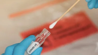 AUMENTAN LOS  CASOS DE COVID-19 EN SANTA CRUZ, HAY 290 CONTAGIOS