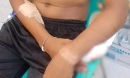 CON UN FIERRO INCRUSTADO EN EL BRAZO DEAMBULO DE HOSPITAL EN HOSPITAL SIN SER ATENDIDO