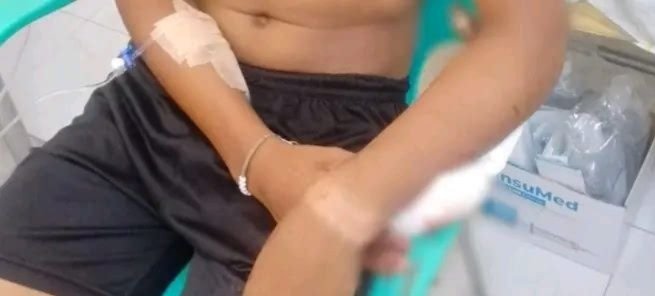 CON UN FIERRO INCRUSTADO EN EL BRAZO DEAMBULO DE HOSPITAL EN HOSPITAL SIN SER ATENDIDO