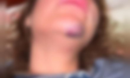 MUJER DENUNCIA BRUTAL AGRESIÓN PROPINADA POR SU EXPAREJA