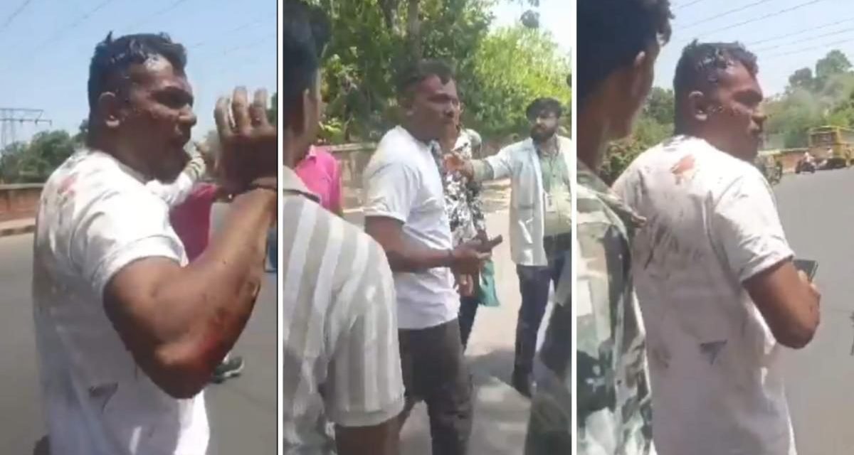 ASÍ SALIÓ CAMINANDO EL ÚNICO SOBREVIVIENTE DEL AVIÓN DE AIR INDIA QUE SE ESTRELLÓ