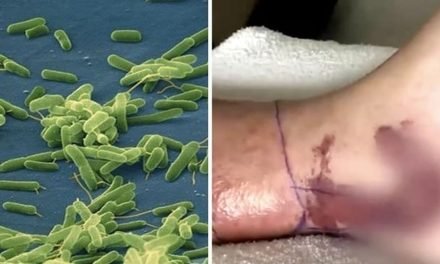 PREOCUPACIÓN EN EEUU POR EL AUMENTO DE MUERTES POR BACTERIAS CARNÍVORAS