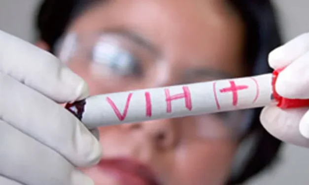 VIH-SIDA: EL ENEMIGO QUE CIRCULA SIN SER VISTO