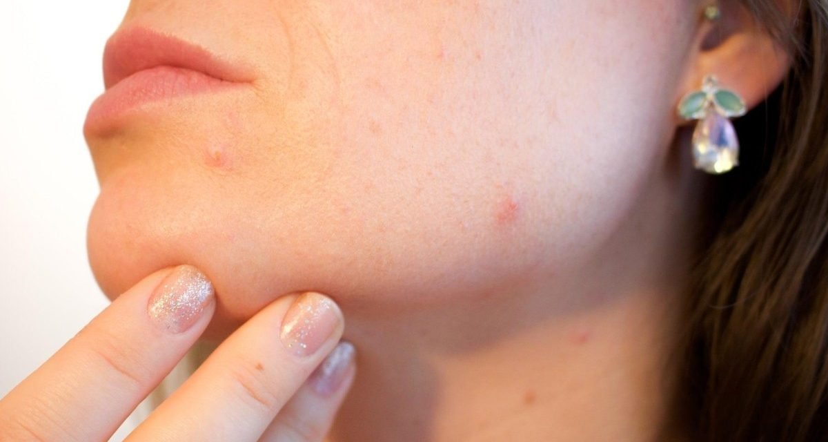 VARIABLES DEL VIRUS DE PAPILOMA HUMANO