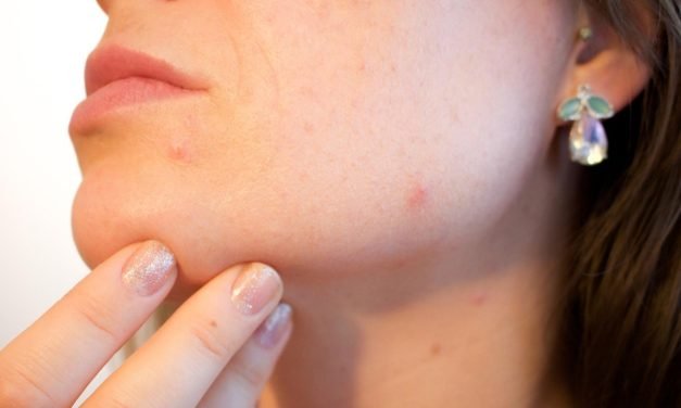 VARIABLES DEL VIRUS DE PAPILOMA HUMANO