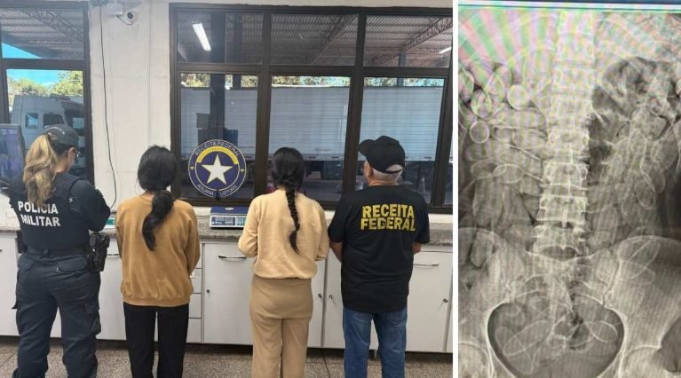 CAEN EN LA FRONTERA CON CORUMBÁ DOS JÓVENES BOLIVIANAS CON MÁS DE 200 CÁPSULAS DE DROGA EN EL ESTÓMAGO