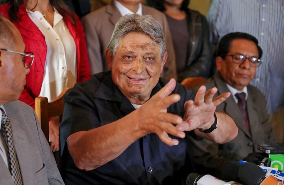 JAIME PAZ ZAMORA ENFRENTA UNA COMPLICACIÓN DE SALUD QUE AFECTÓ SU MOVILIDAD