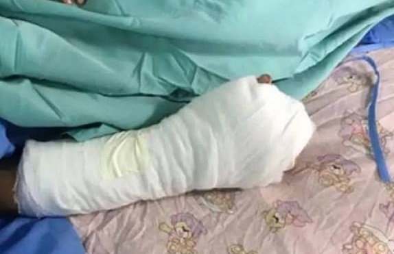 NIÑO SOBREVIVIENTE DEL INCENDIO PERMANECE EN TERAPIA INTENSIVA CON LESIONES CEREBRALES
