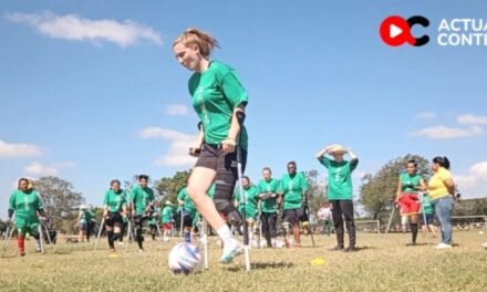 TALENTO Y SUPERACIÓN EN LA CANCHA: MUJERES CON AMPUTACIÓN VIVEN EL FÚTBOL