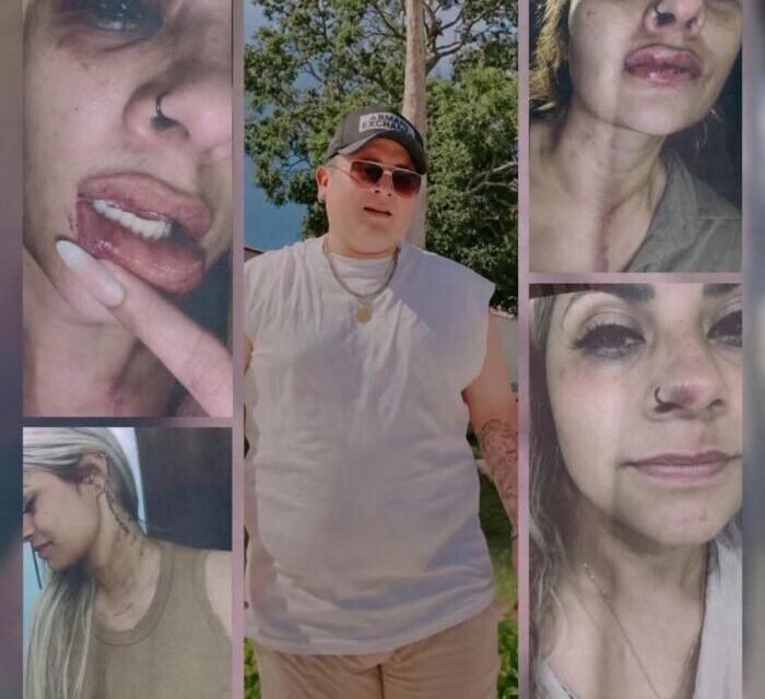 DENUNCIAN A CANTANTE DAVID SOLIZ POR PRESUNTA AGRESIÓN A SU PAREJA